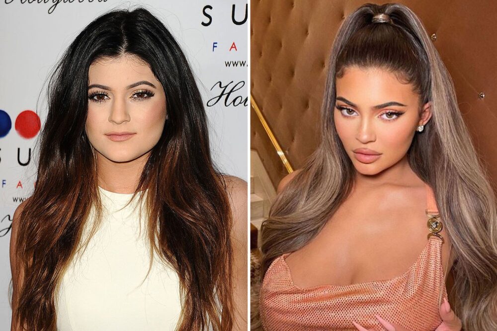 Kylie Jenner Avant Et Après Ses Chirurgies Esthétiques