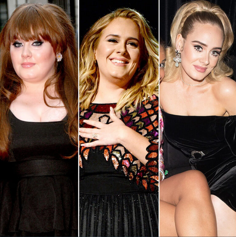Adele, avant et après chirurgie esthétique et perte de poids